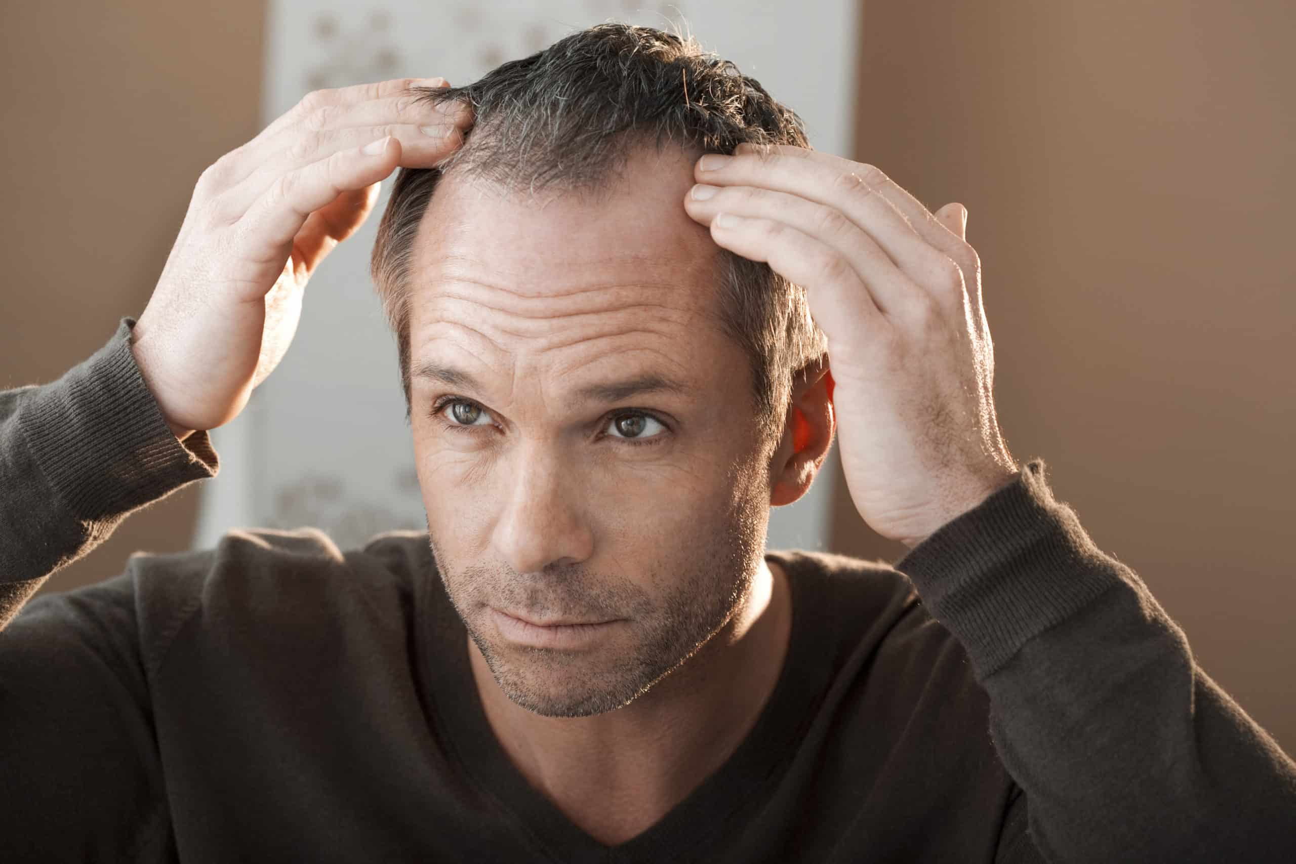 Male Pattern Baldness Treatment Ogden Regeneration Health